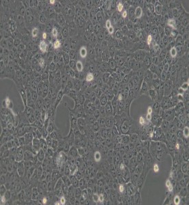 CAL-27人舌鱗癌細(xì)胞主圖