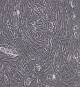 EA.hy926人臍靜脈細胞融合細胞主圖