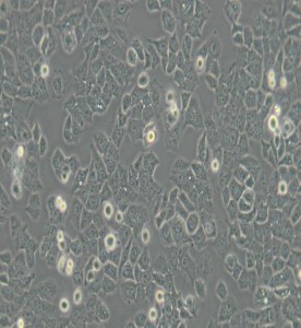 Ishikawa人子宮內膜癌細胞主圖