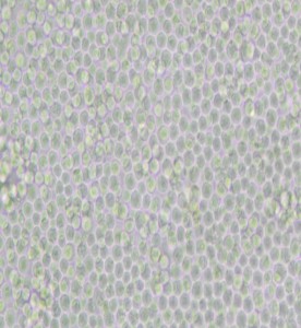 P388D1小鼠淋巴樣瘤細胞主圖