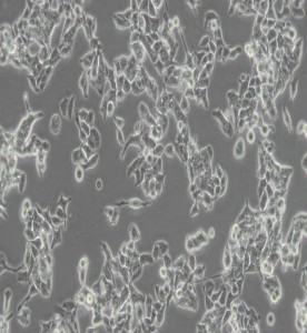 LS-174T人結(jié)腸腺癌細胞主圖