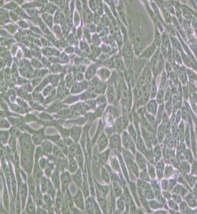 R-1610倉鼠肺細胞主圖