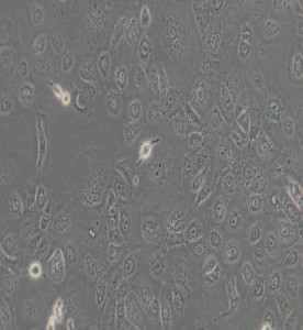 NCI-H1650人非小細胞肺癌細胞主圖