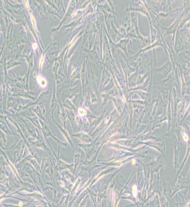 NCI-H2452[H2452]人間皮瘤細胞主圖