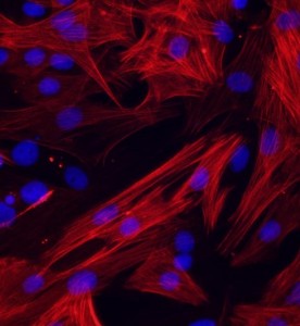 大鼠肺大動脈平滑肌細胞主圖