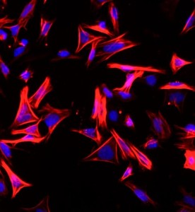 大鼠結腸平滑肌細胞主圖