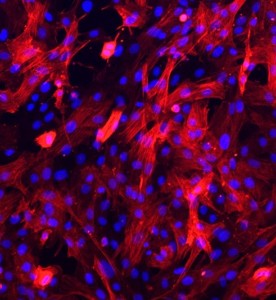 大鼠主動(dòng)脈平滑肌細(xì)胞主圖