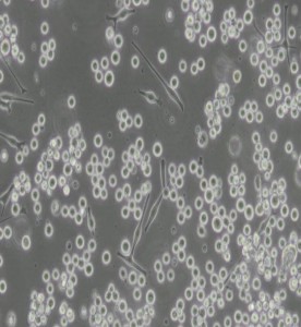 SK-MEL-1人皮膚黑色素瘤細(xì)胞主圖