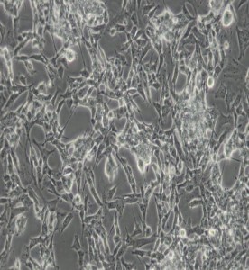 SK-N-BE(2)-C人神經母細胞瘤細胞主圖