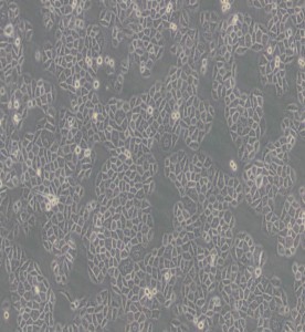 SPC-A-1人肺腺癌細(xì)胞主圖