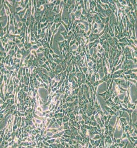 SUM159PT人乳腺癌細胞主圖