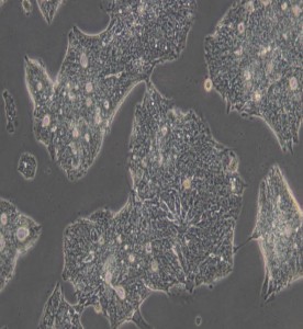 T84人結腸腺癌肺轉移細胞主圖