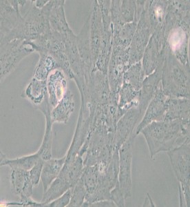 NCI-H196人小細胞肺癌細胞主圖