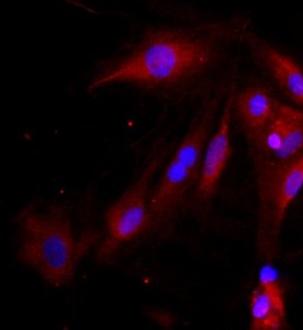 大鼠視網(wǎng)膜Muller細胞主圖