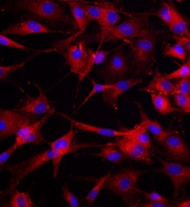 大鼠骨髓來源內(nèi)皮祖細(xì)胞主圖