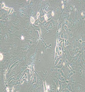 NCI-H2347人肺癌細胞主圖