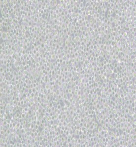 Ramos [RA 1]人B淋巴細胞瘤細胞主圖