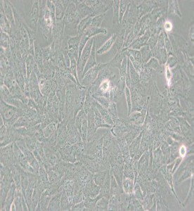 TCCSUP人膀胱癌細胞主圖