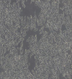 TT人甲狀腺導(dǎo)管癌細(xì)胞主圖