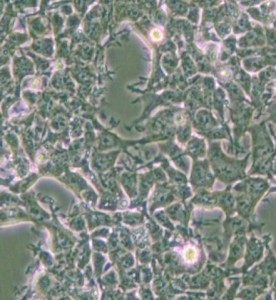 2V6.11人胚腎細胞主圖