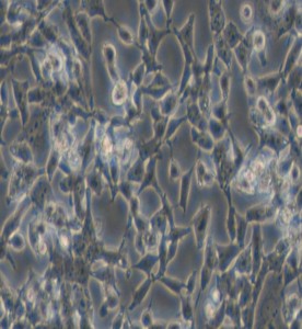 D283 Med人腦髓母細胞瘤細胞主圖