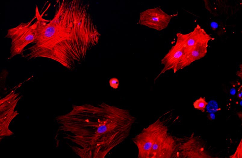 小鼠主動脈平滑肌細胞主圖