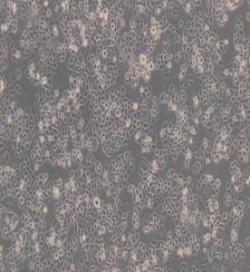 C-33 A人子宮頸癌細胞主圖