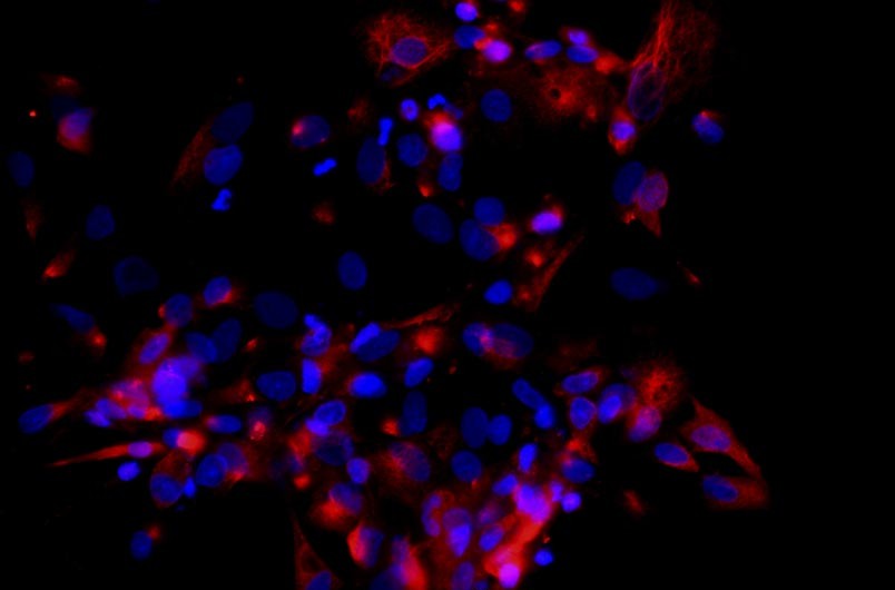 小鼠肝外膽管上皮細胞主圖