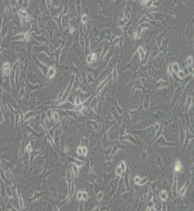 C918人眼脈絡黑色素瘤細胞主圖