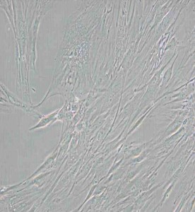 CCD-1095Sk人乳腺浸潤性導管癌旁皮膚細胞主圖