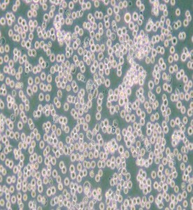 JM人T淋巴細胞白血病細胞主圖