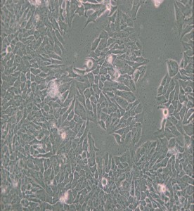 MDA-MB-361人乳腺癌細(xì)胞(DMEM) 主圖