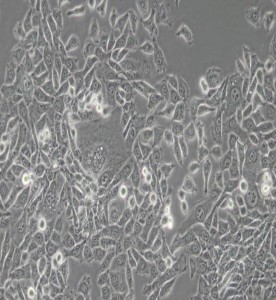 MDA-MB-415人乳腺癌細胞(DMEM) 主圖