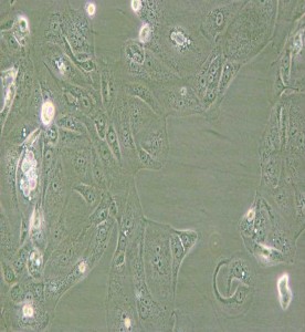 MKN-7[MKN7; MKN7]人胃癌細胞主圖