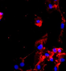 人臍動脈內(nèi)皮細胞主圖