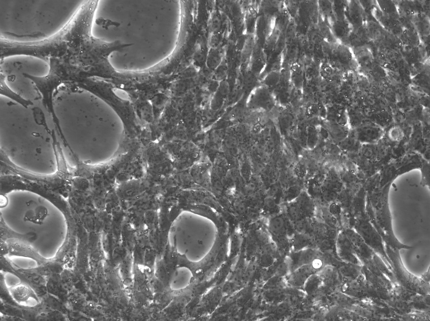HEP-53.4 小鼠肝癌細胞主圖