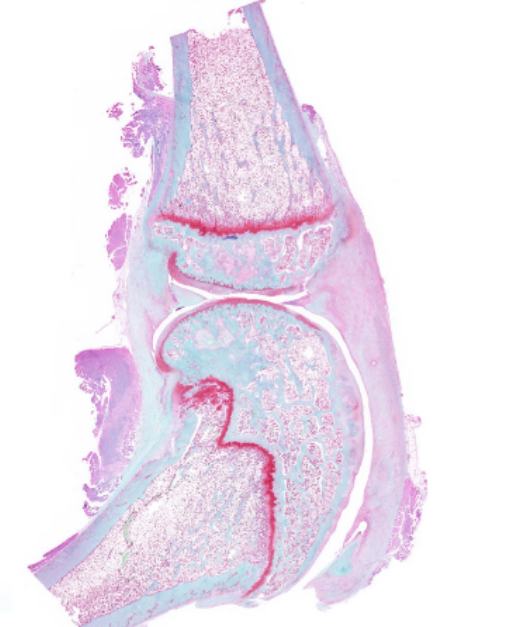 骨組織EDTA脫鈣 (慢脫)主圖
