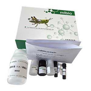 Annexin V-FITC細(xì)胞凋亡檢測(cè)試劑盒(TMR紅色熒光)主圖